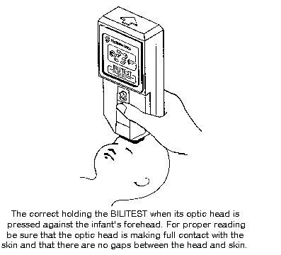 Fig. 1. The correct holding the BILITEST (6 Kb)